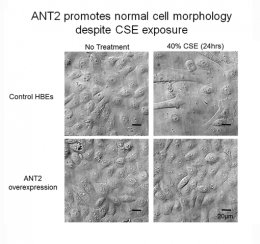 ANT2 maintains normal cell morphology of human bronchial epithelial cells after 40% cigarette smoke extract after 24 hours from Kliment et al. 2015.