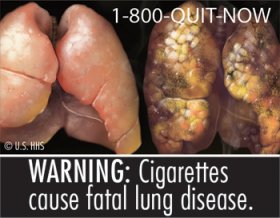 FDA Unveils New Cigarette Health Warnings - (JPG)