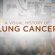 History of lung cancer