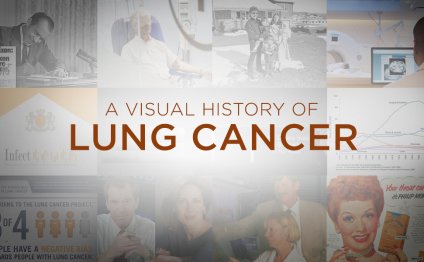 Lung cancer History