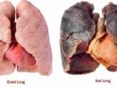 Tobacco and lung cancer