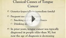 What CAUSES Tongue Cancer? Smoking, drinking, Sex, Kissing